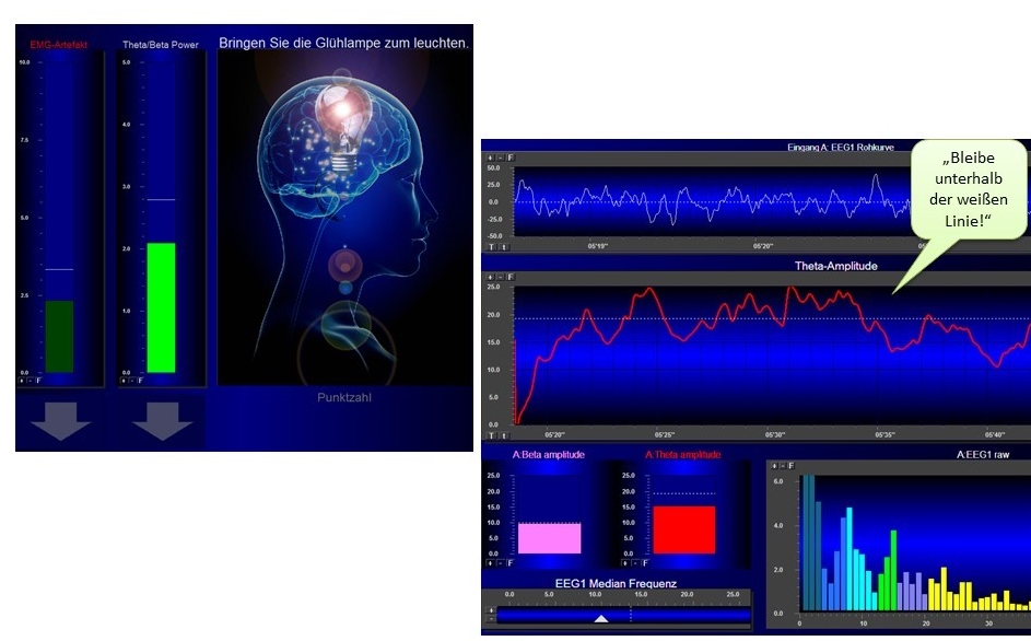 Neurofeedback_Behandlung_Trainingsscreen.jpg